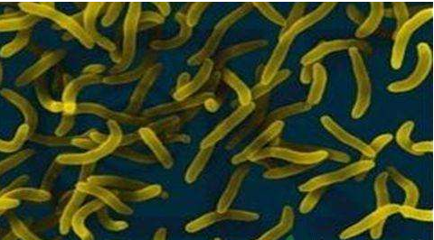 微生物菌劑好？好在哪里您知道嗎？